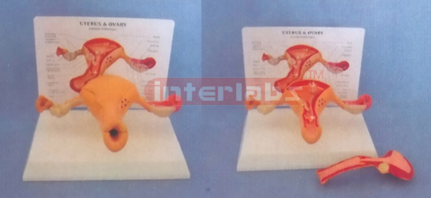 WEST DESK TYPE, COMMON PATHOLOGIES UTERUS & OVARY WIDESCRIPTION PLATE (2 PCS) WITH COVER AND THE LESSER LIPS OF PUDENDUM